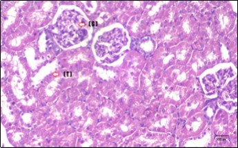 photomicrogragh of kidney section of control rat showing normal rounded Bowman,s capsules with normal glomeruli (arrow) ,round proximal tubules (dash-arrow) and elongated distal tubules with high cuboidal cells (star) . (H&E) (40X)