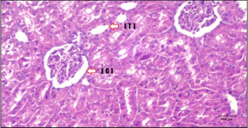 Photomicrogragh of kidney section of treated rat with Glimepiride showing improvement of Bowman,s capsules and partial improvement of glomerulir (arrow) and completely return of distal tubules and proximal tubules to the normal shape with wide urinary space. (H&E) (40X).