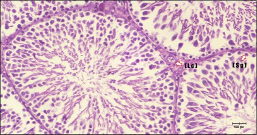Photomicrogragh of testis section of a control rat showing testicular tissue with seminiferous tubules separated by interstitial tissue with Ledying cells (arrow). Seminiferous tubules with complete spermatogenesis, Sertoli cell (dashed-arrow) and spermatozoa . (H&E) (40X).