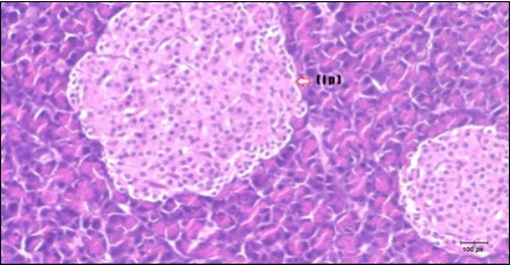 Photomicrogragh of pancreas section of control rat showing the pale islets of Langerhans contained spindle shape cells (arrow) &polygonal one (dashed- arrow). Strom contained blood vessels (BV) and pancreatic acini (circle) with pyramidal cells have basophilic nucleus at the base. (H&E) (40X).
