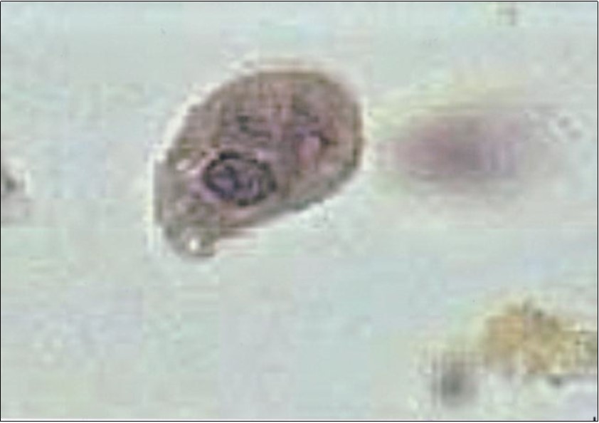 Entamoeba histolytica Trovozoite