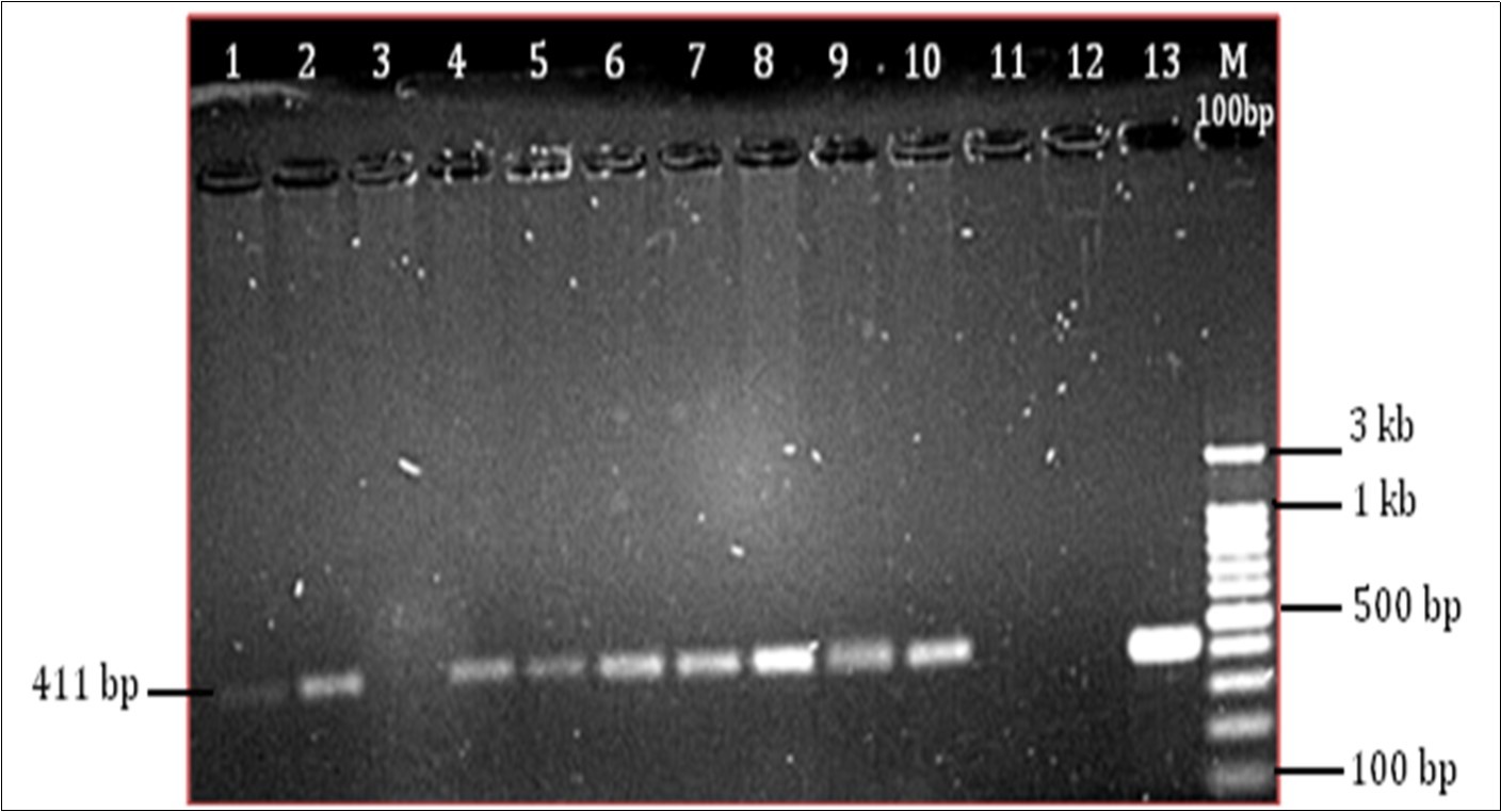 Agarose gel electrophoresis 1.5% gel showing product size 411 bp. (Well no. 1-10 PCR products from sample no. 1 to 9 , except the well no.3 is blank), (well no 11- blank, 12- Negative control, 13- Positive control (M. tuberculosis H37Rv)), (M- 100 bp marker)