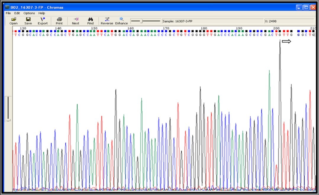 Mutation screening at codon position 531 of 81 bp (RRDR) region of rpoB gene (531 position TCG – TTG i.e. Serine – Leucine change indicates drug resistance)
