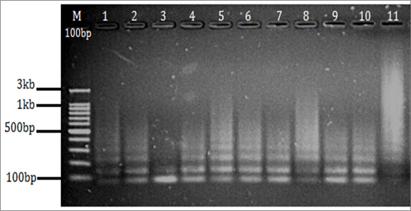 Agarose gel electrophoresis 1.5% gel showing amplification of DR region. (M- 100 bp marker Well no. 1-9 PCR products from sample no. 1 to 9, well no 10- Positive control(M. tuberculosis H37Rv), 11- Negative control.