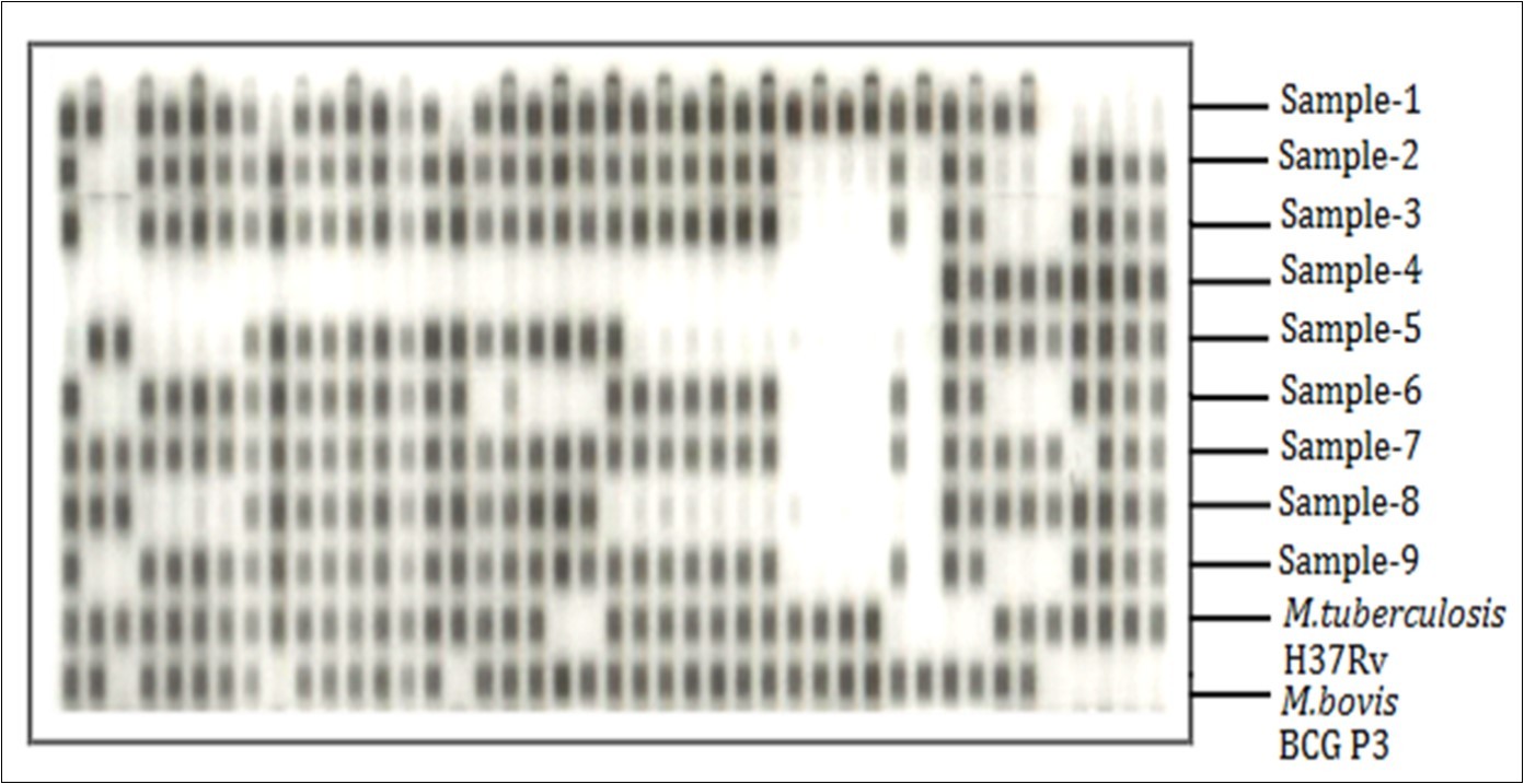 Spoligotyping hybridization pattern of amplified mycobacterial DNAs of 9 samples and 2 controls M.tuberculosis H37Rv, M.bovis BCG P3. Dark spots represent the positive hybridization & empty spots represent no hybridization i.e. absence of spacers.
