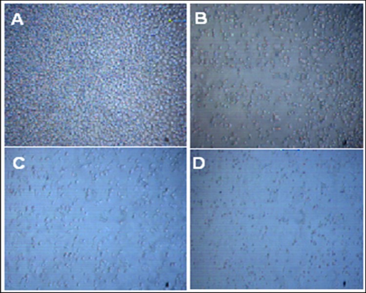 HTB-132 breast cancer cells cytotoxicity before and after 72 hrs alendronate treatment. A: Control; B, C & D: 5µM, 10 µMand 20 µM ALN respectively.