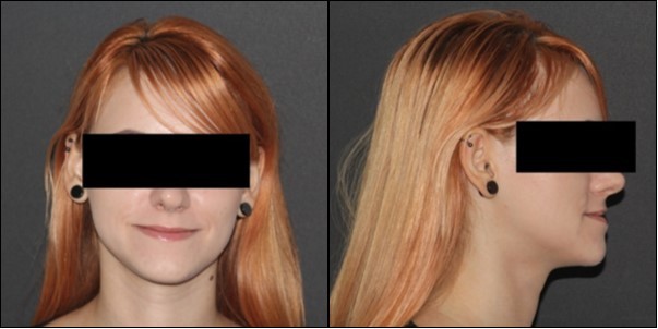 Initial extraoral photographs