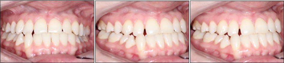 Initial intraoral photographs