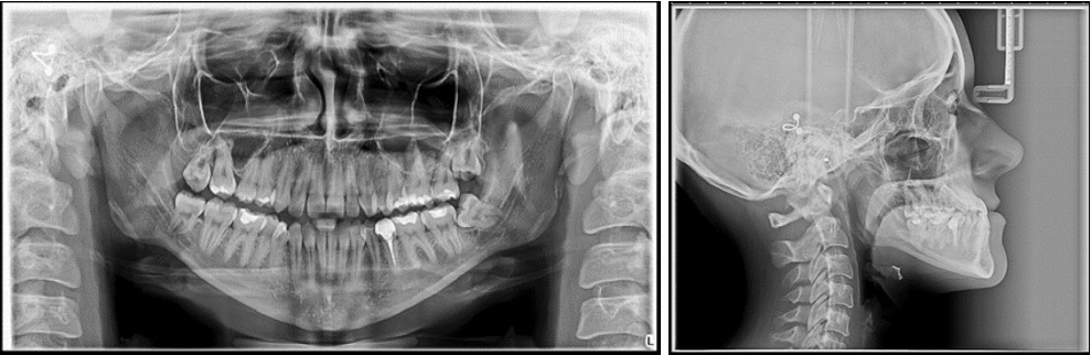 Initial panoramic and lateral cephalometric radiographs