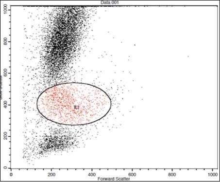 A. Forward Scattering (Normal control)