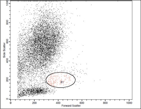 B. Forward Scattering (LC Patient)