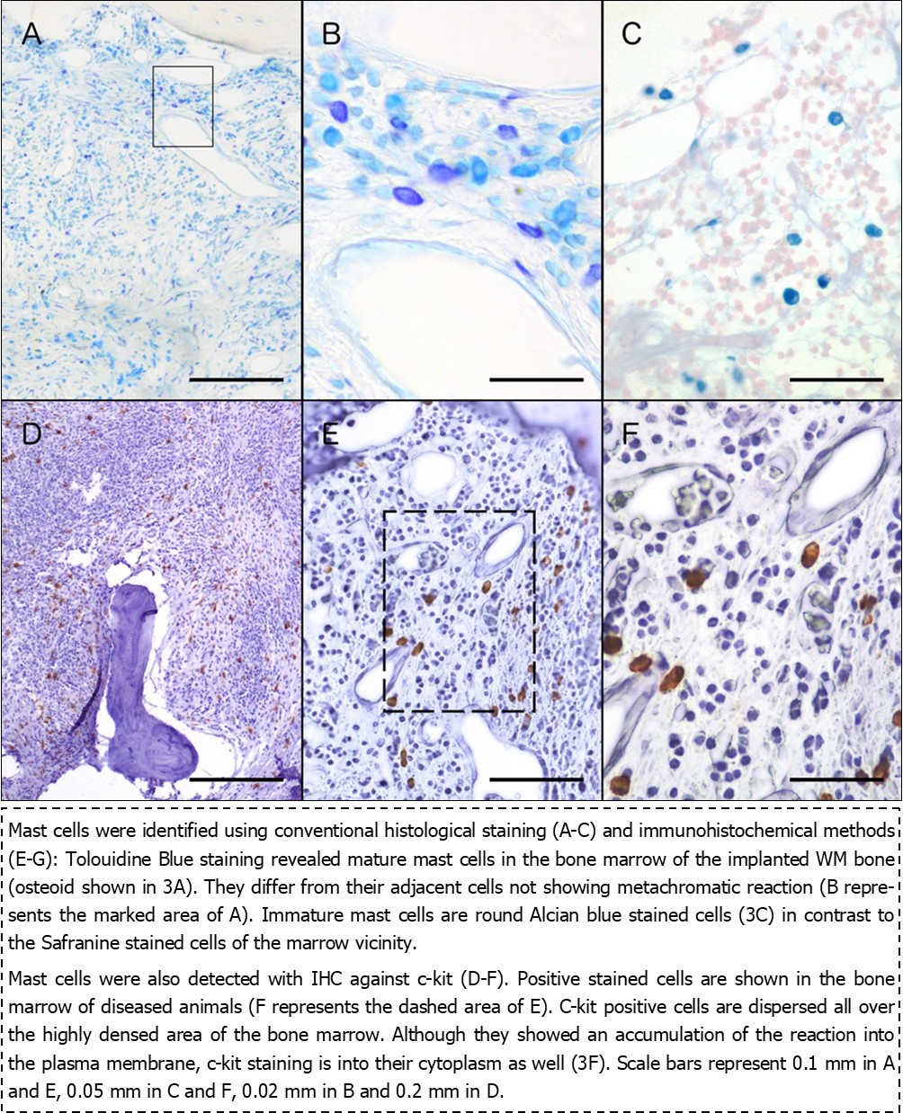 Histological (A-C) and immunohistochemical (D-F) staining of mast cells in WM biopsies.