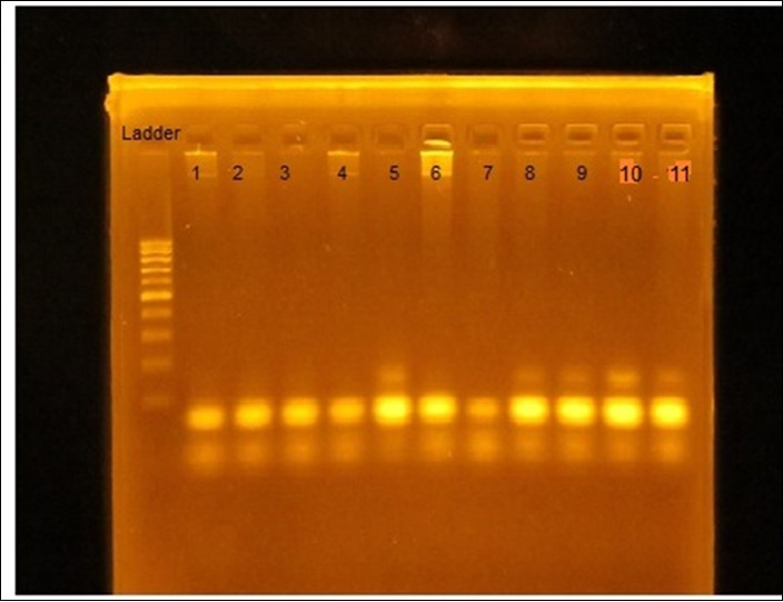 Gel picture of PCR products digest by HindIII restriction enzyme (HAMP). 100 b.p DNA Ladder (100–1000 b.p). Lane 1, 2, 3, 4, 6, 7 : GG homozygote alleles (bands at 90 bp and190 bp). Lane 8, 9, 10, 11: AG heterozygote alleles (bands at 90 b.p, 190 b.p, and 200 b.p). Lane 5: AA homozygote alleles (band at 200 bp).