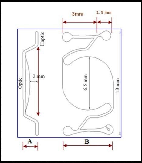 Intraocular lens design, with posterior chamber optic and angle-supported haptics. Lateral view (A) and anterior view (B) with different IOL dimensions.