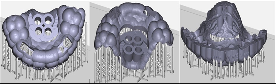 Final preview of the surgical guide before printing