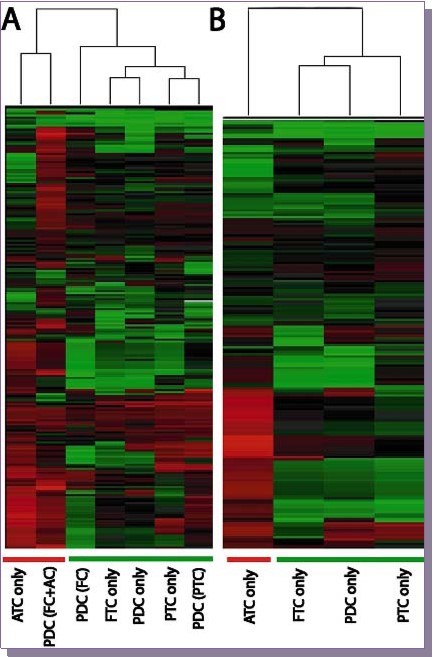 A Comparison of miRNA of set B cases with WTC demonstrates that PDC in a background of either FC or PTC clusters together (separate from ATC only and PDC in a background of ATC). C, FTC, PTC and PDC cluster together separate from ATC.
