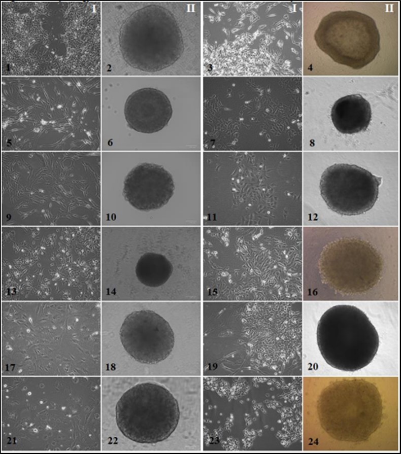Мorphology of the established solid tumor cell cultures and spheroids I-monolayer tumor cell cultures, II-spheroids composed of tumor cells (monospheroids). 1, 2 – alveolar sarcoma #927, 10 passage; 3, 4 – melanoma #860, 35 passage; 5, 6 – leiomyosarcoma #699, 16 passage; 7, 8 – melanoma #912, 25 passage; 9, 10 – rhabdomyosarcoma #862, 20 passage; 11, 12 – melanoma #929, 51 passage; 13, 14 – synovial sarcoma #716, 25 passage; 15, 16 – renal cancer #584, 40 passage; 17, 18 – myxofibrosarcoma #728, 19 passage; 19, 20 – colon cancer #485, 12 passage; 21, 22 – osteosarcoma #921, 12 passage; 23, 24 – bladder cancer #875, 15 passage. Inverted microscope, phase contrast, 100 µm scale value.