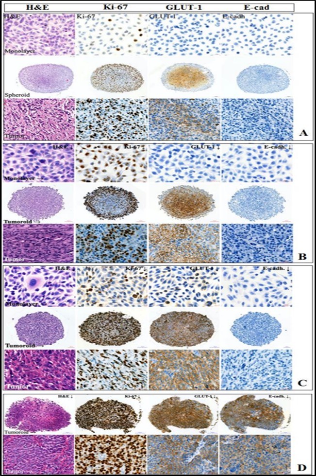 Identification of Ki-67, GLUT1, E-cadherin in solid tumor cells from different experimental systems. A - #921 osteosarcoma, 10 passage, spheroid ⊘ 752.7 μm; B - #912 melanoma, 19 passage, ⊘ 683 μm; C - #982 myxofibrosarcoma, 33 passage, ⊘ 611.8 μm; D - #973 breast cancer, 27 passage, ⊘ 690 μm. Monolayer culture - 20 μm scale bar; spheroid - 100 μm scale bar; tumor tissue - 20 μm scale bar. From left to right: hematoxylin-eosin staining; proliferative activity marker Ki-67; GLUT1 - glucose transporter protein; cell adhesion protein E-cadherin. different experimental systems.