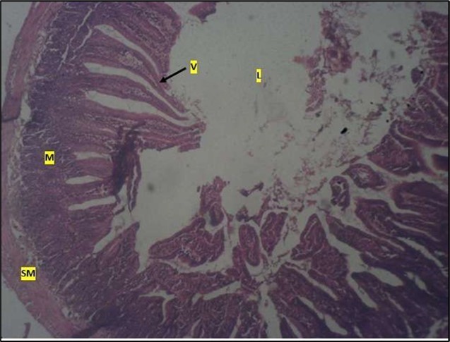 High dose showing a normal mucosa (m) with villi (v) projecting towards the lumen(l) and underlying smooth muscle layer (sm). No pathology seen