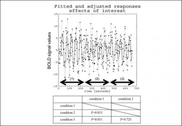 The amplitude of vascular response of primary visual cortex.The amplitude of vascular response of condition 1 (1) was higher than condition 2 (2) and 3 (3) (P<0.05).