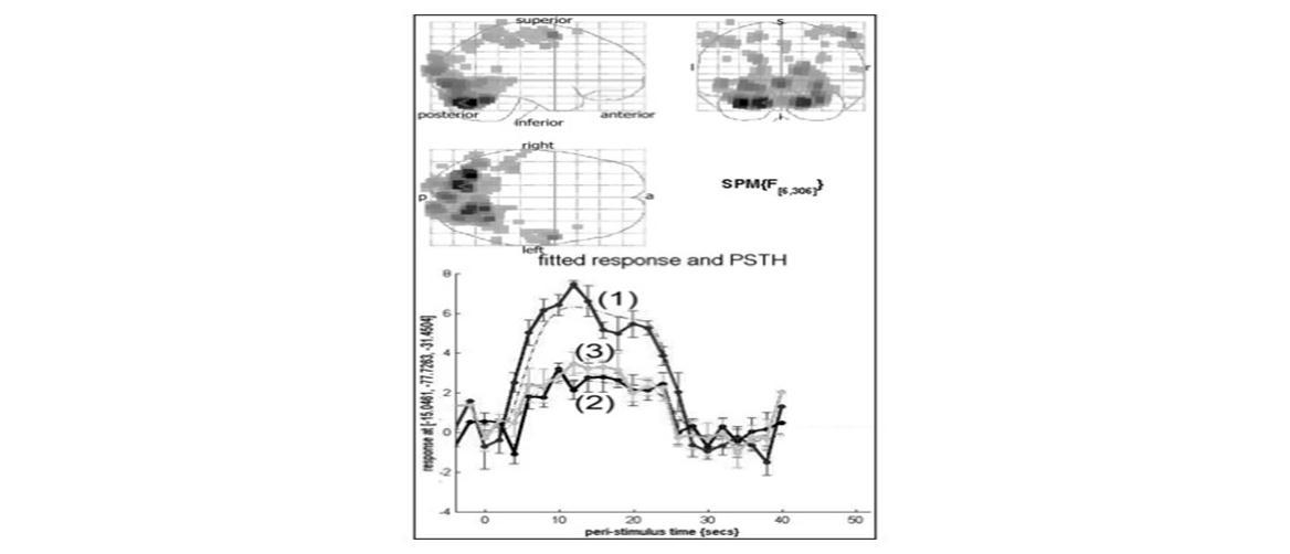 Fitted response and PSTH in primary visual cortex. The average response to an event type with mean signal +/- SE for each peri-stimulus time bin. Response of condition 1 (1) was higher than condition 2 (2) and 3 (3) in primary visual cortex (P<0.05).