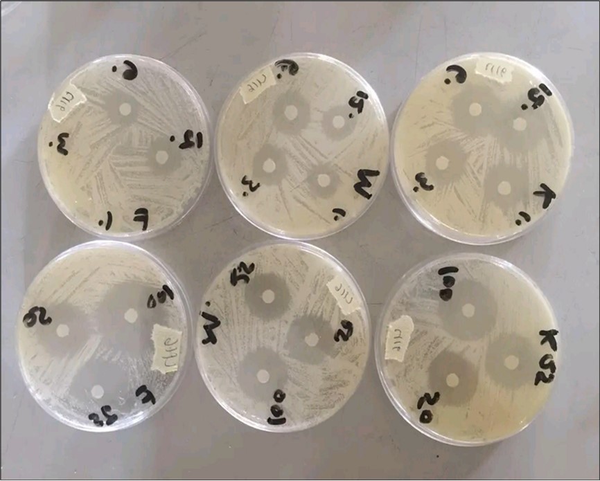 Plates showing zone of inhibitions of Antifungal agents to Test Isolates.