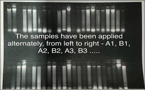Electrophoresis of extracted DNA on 1% agarose gel.