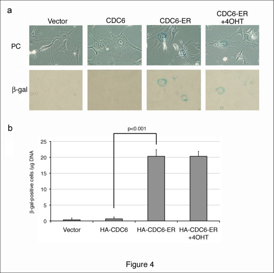 Cytoplasmic CDC6 induced SA-b-Gal activity NIH3T3 cells were transfected with HA-CDC6 and HA-CDC6-ER vectors together with a GFP-neo marker plasmid, selected in G418, and stained for SA-b-Gal activity. HA-CDC6-ER-transfectants were incubated in the presence of 4OHT (+4OHT) from the beginning of transfection, selected in G418, and stained. Photos of stained cells (a) and the results of enumeration (b) are shown.