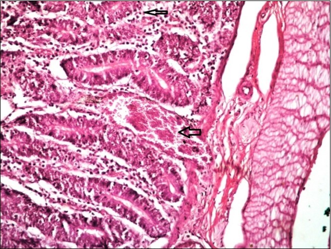 Small intestine (dead cattle less than 1 year old) showed hydropic degeneration, congested blood vessels, inflammatory cells (H&E, X 30).