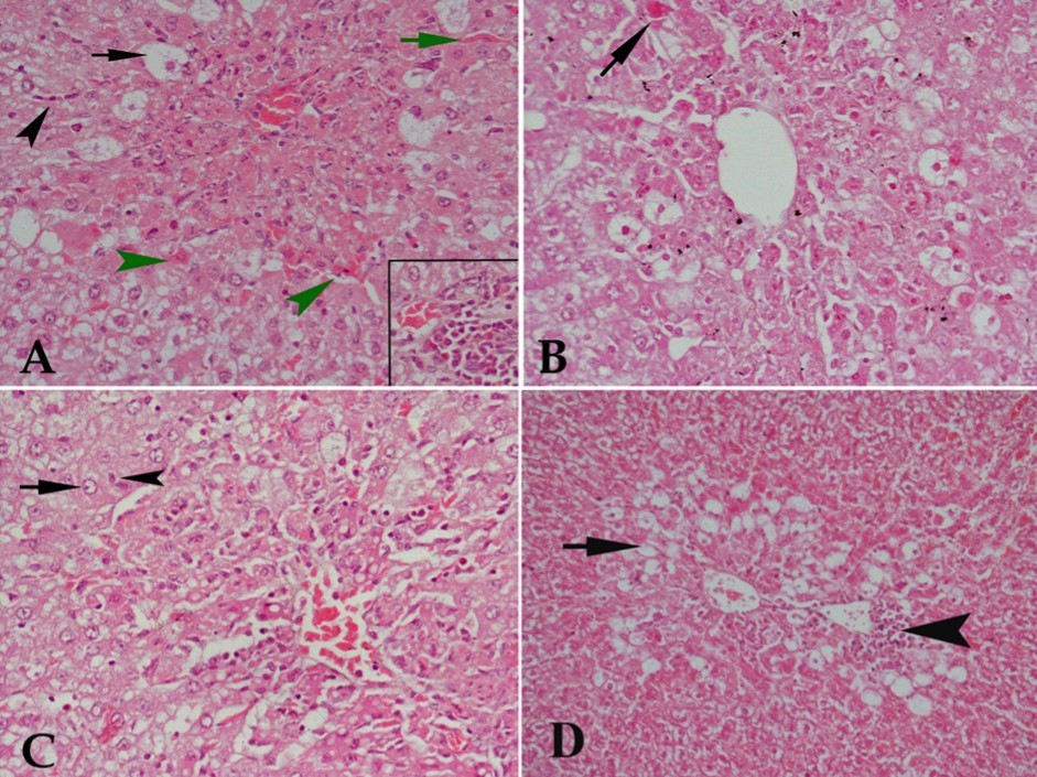 Hx & E stained liver tissue from (A) control rat receiving CCl4 showing severe degenerative changes in liver tissue in the form of marked vacuolar degeneration of many hepatocytes (black arrow), acidified hepatocytes (green arrowhead), congestion of blood sinusoids (green arrow) and cellular infiltration either diffuse in the center of the lobule or in blood sinusoids (black arrowhead). The lower right part of the figure shows focal aggregation of cellular infiltrates. (B) CCl4 and 10 mg/kg buspirone showing no protective effect against the damaging effect of CCl4 as acidified cells (arrow), vacuolar degeneration of most hepatocytes and cellular infiltration are still observed. (C) CCl4 and 20 mg/kg buspirone showing minimal protection against the damaging effect of CCl4 as some cells appear with normal nuclei (arrow) and others are with pyknotic nuclei (arrowhead), although many cells show vacuolar degeneration, cellular infiltration in the center of the lobule is still present and architecture of liver tissue is markedly deformed. (D) CCl4 and 30 mg/kg buspirone showing mild protection of the drug against the damaging effect of CCl4 . Cellular infiltration is localized at focal areas beside central vein (arrowhead) with restriction of vacuolar degeneration to the area around central vein (arrow).