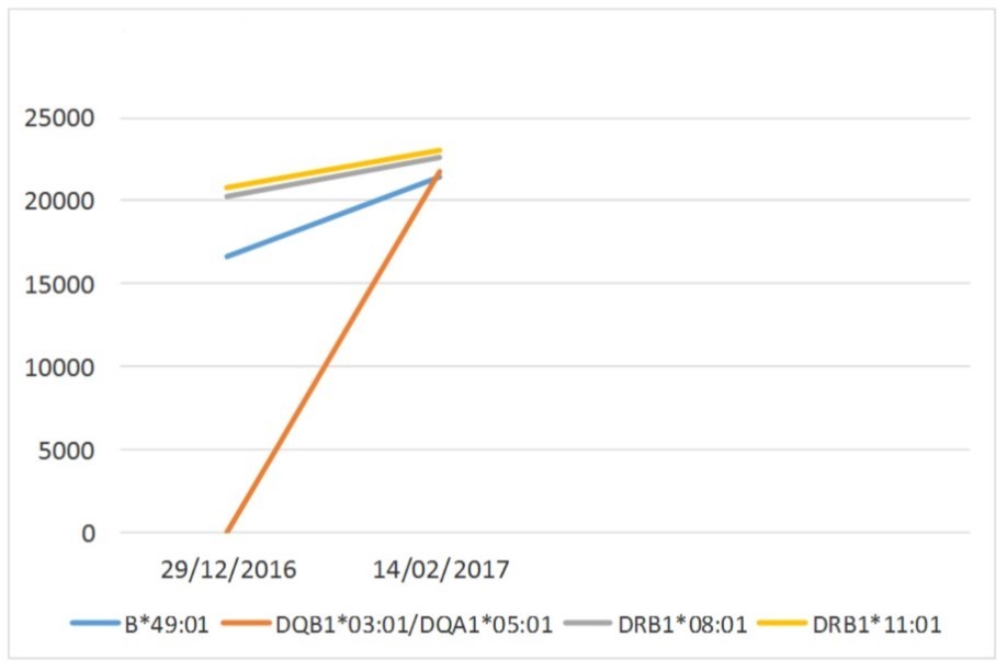 DSAs against HLA antigens of sister and son pre and after desensitization.