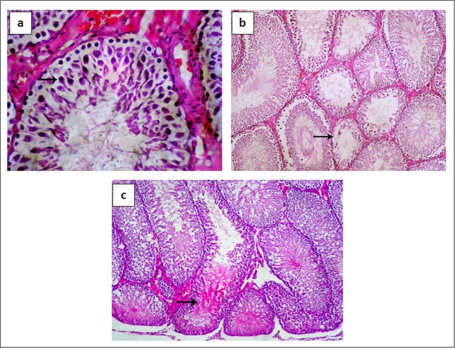 Histopathological results. a) Control group: seminiferous tubules with normal spermatogenic epithelium (arrow), normal Sertoli cells and normal interstitial tissue. b) After 6 hours seminiferous tubules display degenerative changes and necrosis of spermatogenic epithelium (arrow) and abnormal Sertoli cells. c) After 72 h necrosis of spermatogenic epithelium lining seminiferous tubules and accumulation of eosinophilic edematous transudate in its lumen.