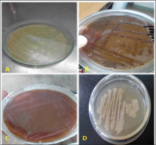 Streak plating of bacterial on their respective differential medium. A= Staphylococcus aureus on Staph 110 agar, B= Salmonella spp. on Salmonella-Shigella agar, C= E. coli on MacConkey’s agarand D= Bacillus subtilis on Eosin methylene blue agar