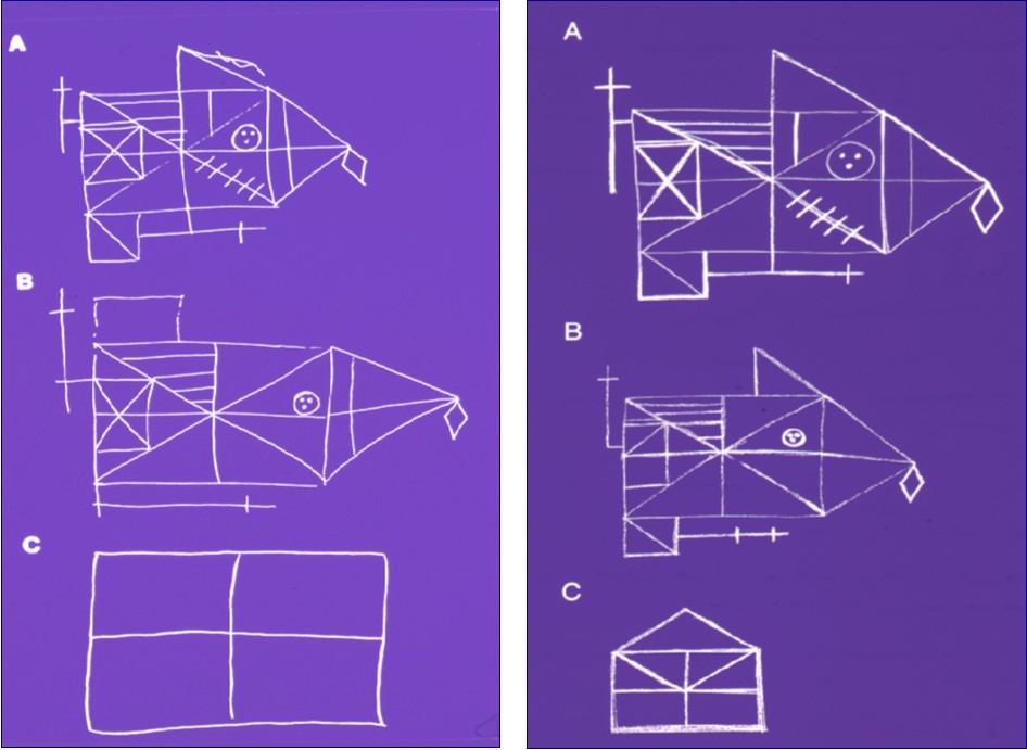 Performance of the anterogradely amnesic patient E in the so-called Rey-Osterrieth Figure, a complex drawing which the patient had to draw repeatedly. The patient first is shown the figure and has to draw it from the original (A). Thereafter she had to draw it a second time by heart after half an hour(B), then a third after an hour (C), and finally a fourth time after 2 hours (E was unable to reproduce it then). Patient E performed the test 3 years (left half of the figure) and 5 years (right half) after amnesia onset. Patient E was able to copy the figure without problems (A), she also was considerably above average when drawing it by heart after half an hour (B); but then, after a further half hour her performance was massively below expectation, and after 2 hours she – on both occasions – did not even remember having drawn the picture.