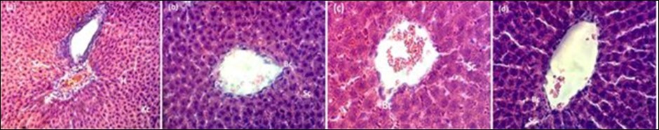 Histology study of liver of rats: (a) control group; (b) 200 mg/kg; (c) 400 mg/kg and (d) 600 of HM stem bark extract in a 28-days subacute toxicity. Biliary canal (Bc), Portal vein (Pv), sinusoidal capillaries (Sc), Kupffer cells (Kc), hepatocytes (H). H.E (X 400).