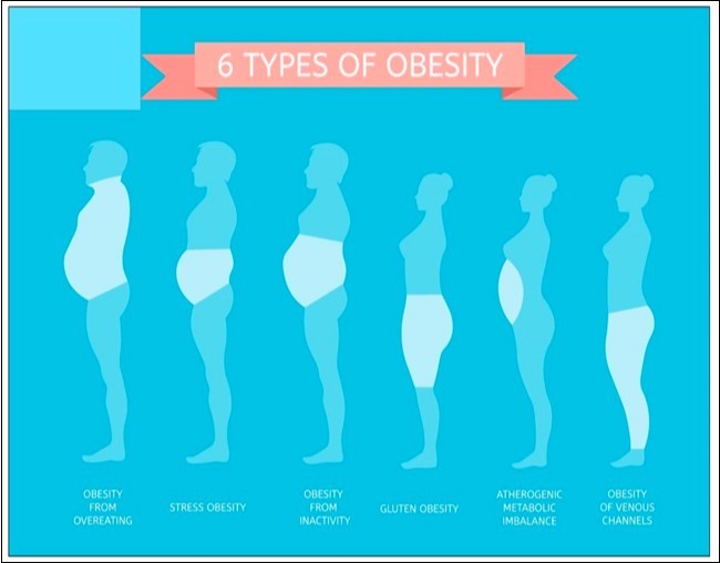 Types of obesity