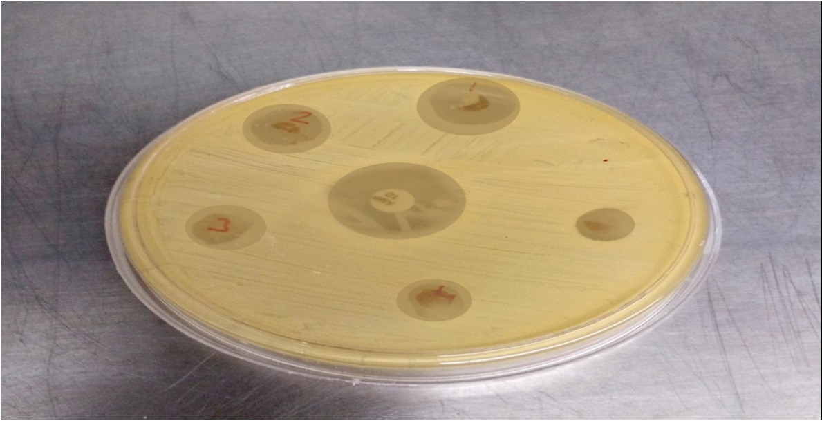 Zone of Copper Neem Soap 2-amino -6-nitro Complex for Coagulase-negative staphylococci (CoNs)