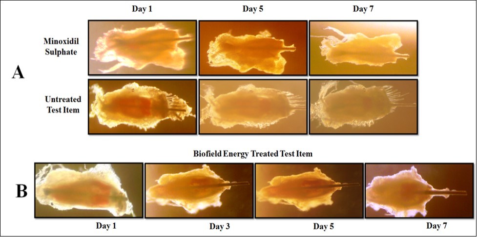 Representative photomicrograph of hair follicle development (anagen - catagen - telogen) of different treatment groups. A: Initiation of anagen follicle (thick hair bulb); B: Transformation of initiation, regression of hair bulb, and shifting of the hair shaft (telogen follicle) in the Biofield Energy Treated test item (William’s Medium E) group .