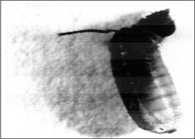 Showing: Head and a leg of the adult fly Musca vicina that remains attached to its light X 63.